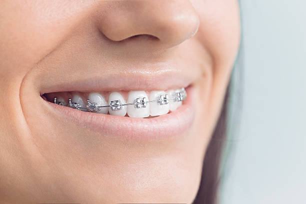 Dental Bonding in West Belmar, NJ